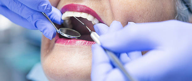 Best Emergency Wisdom Tooth Extraction in Hattiesburg, MS